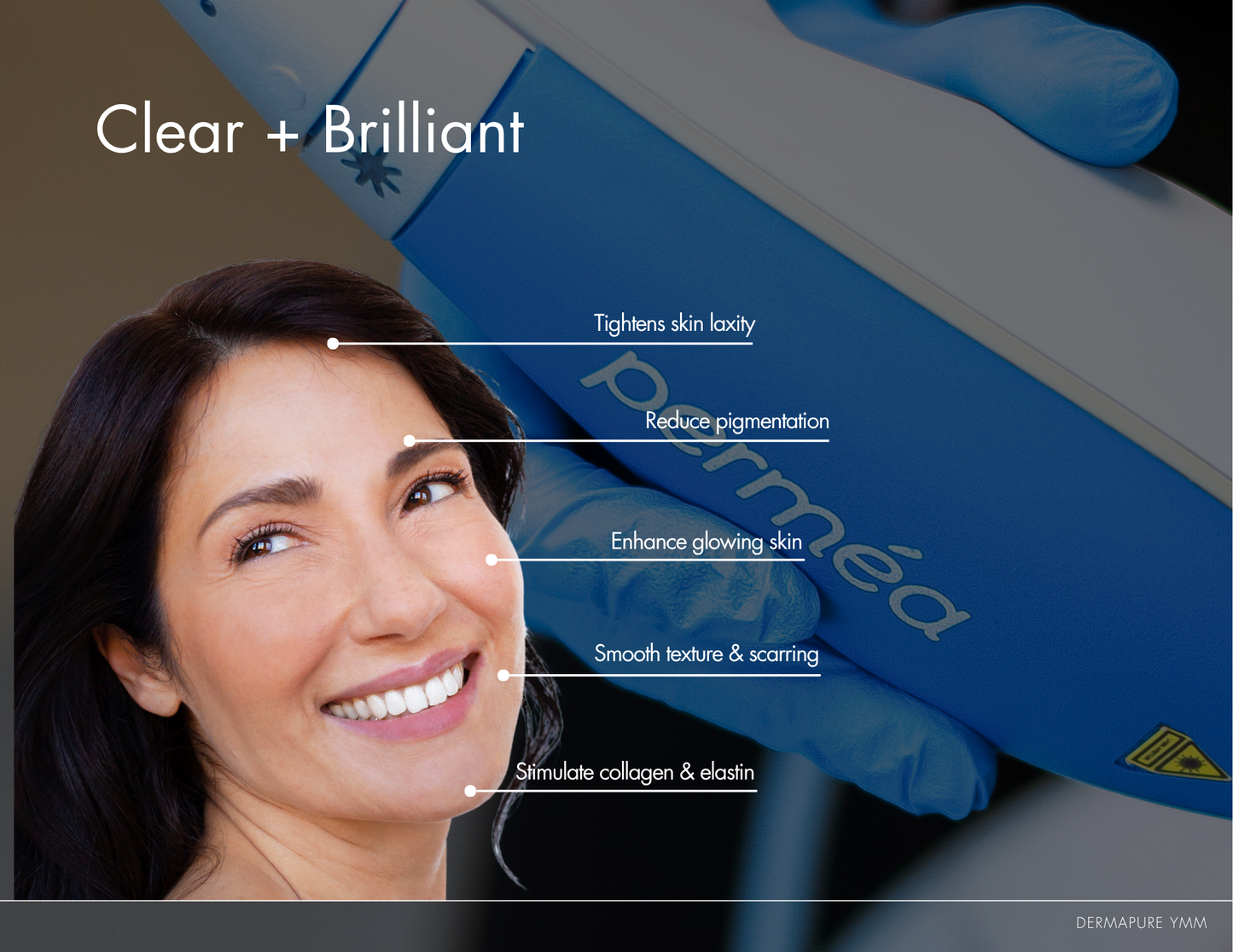 Clear & Brilliant Laser Treatment