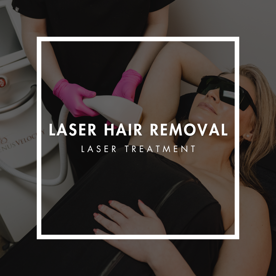 Laser Hair Removal