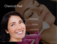 Chemical Peel