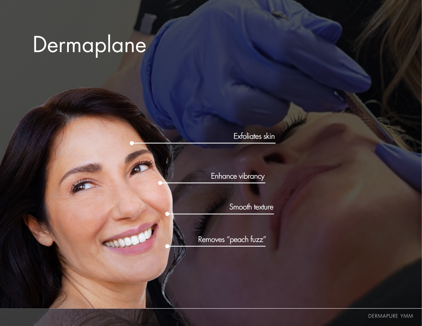 Dermaplane