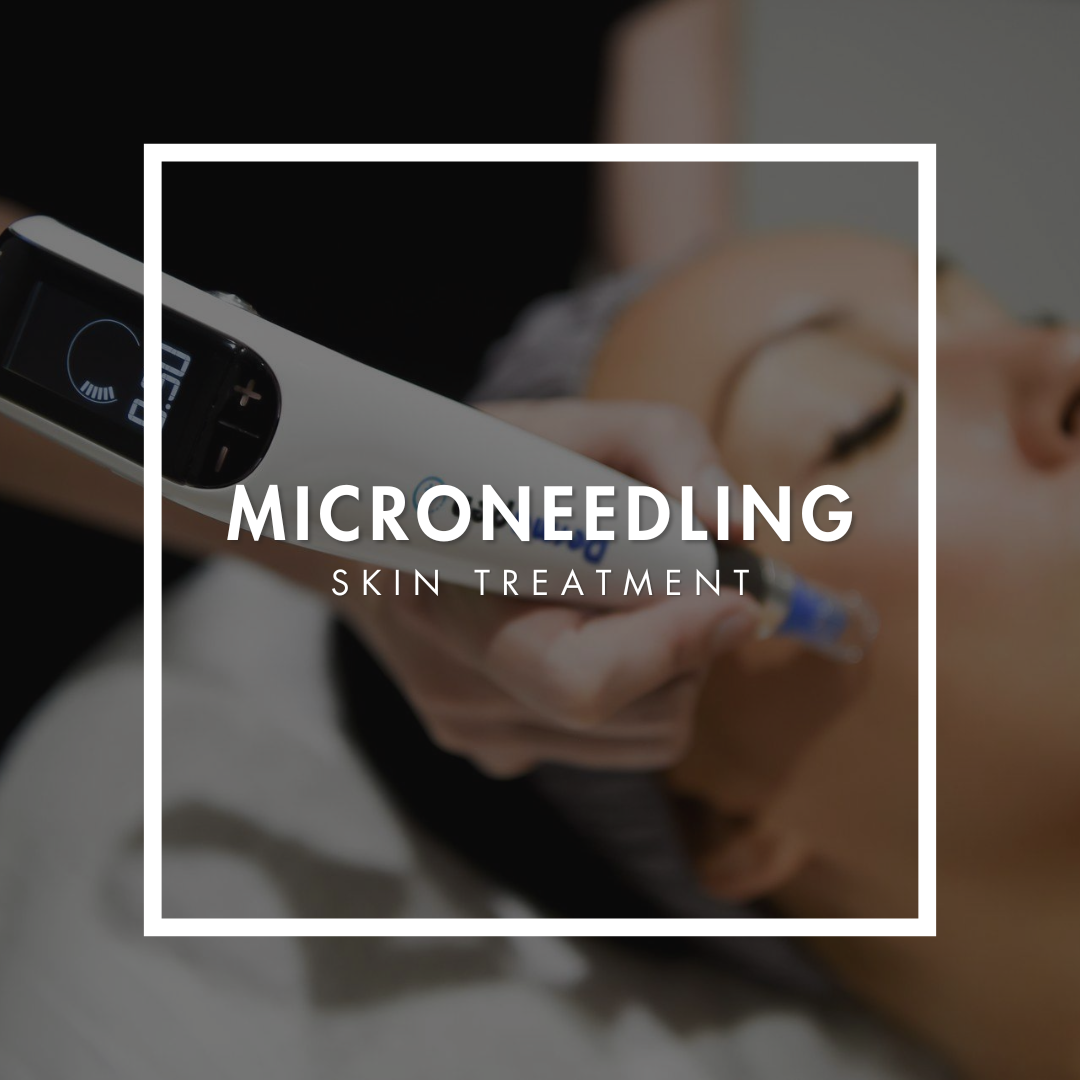 Microneedling