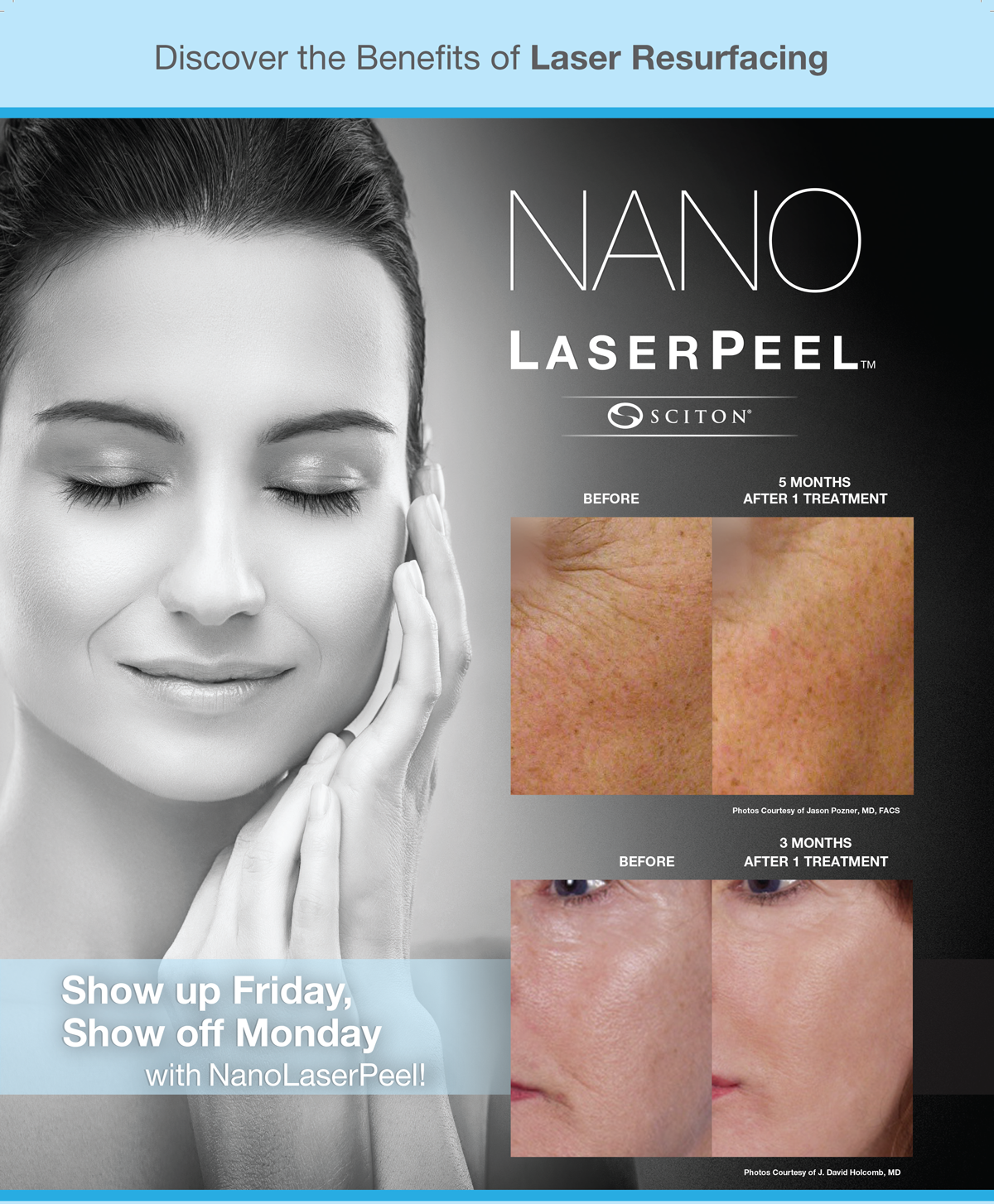 NanoLaserPeel